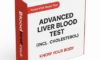 Liver Blood Test Guide: Essential Insights for Maidstone Residents