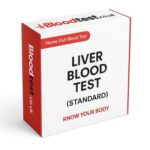Liver Blood Test Information for Slough Residents