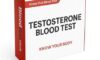 Testosterone Blood Test: Vital Details for Crewe Residents